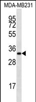 1 - LIX1L Antibody (Center) AP12600c
