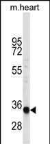 1 - LIX1L Antibody (Center) AP12600c