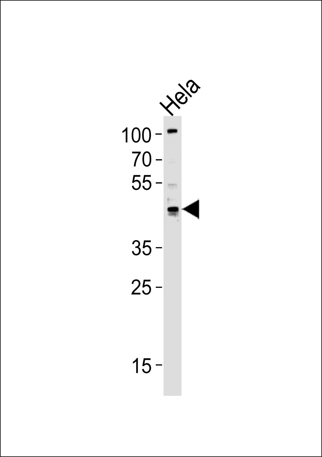 1 - TRIP13 Antibody (C-term) AP12636b