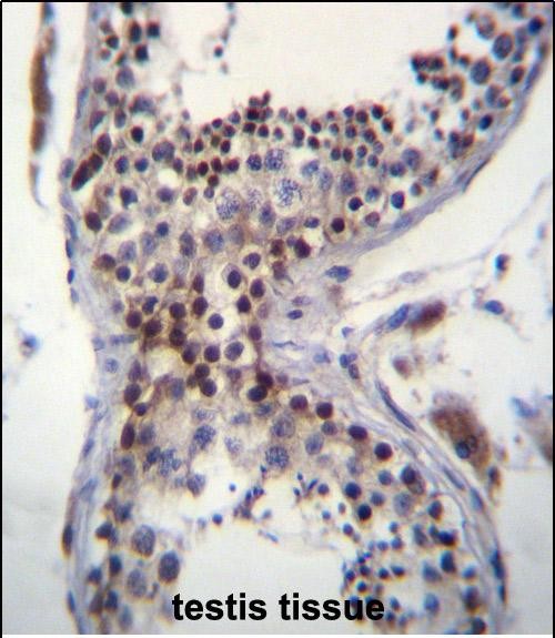 14 - CCDC58 Antibody (N-term) AP12660a
