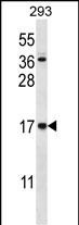 1 - CCDC58 Antibody (N-term) AP12660a