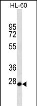 1 - MED22 Antibody (N-term) AP12666a