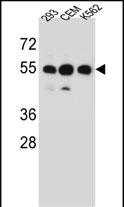 1 - ZNF562 Antibody (N-term) AP12672a