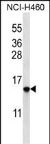 1 - HIST1H2BO/HIST1H2BH Antibody (N-term) AP12711a