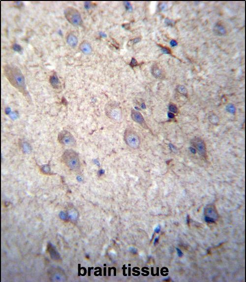 14 - GSTM5 Antibody (N-term) AP12728a