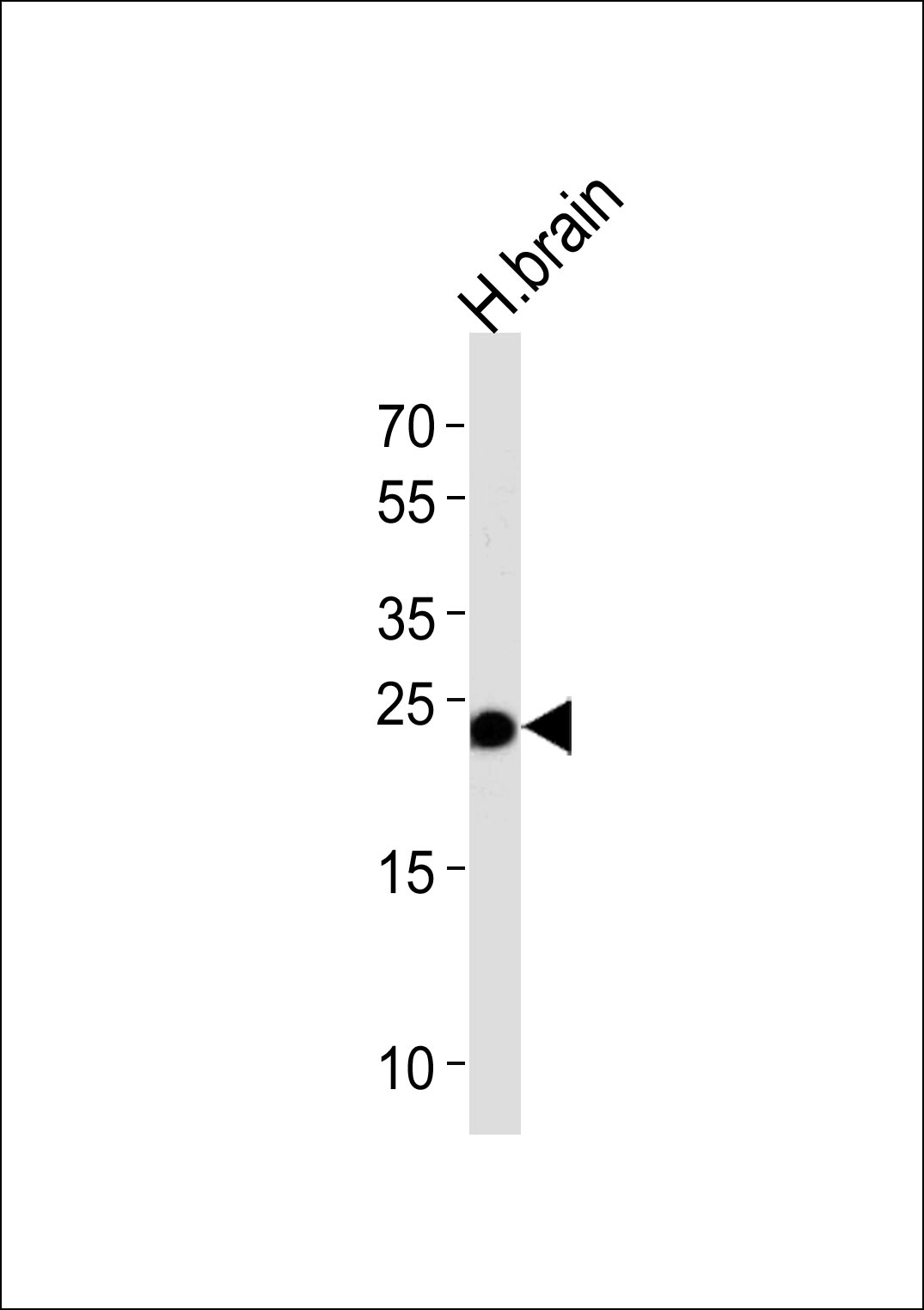 1 - GSTM5 Antibody (N-term) AP12728a