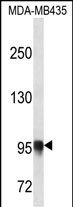 1 - PLOD3 Antibody (N-term) AP12733a