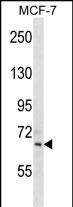 1 - SIGLEC11 Antibody (C-term) AP1629b