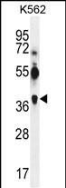 1 - MAGEA12 Antibody (N-term) AP6162a