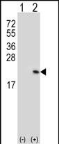 1 - RFK Antibody (N-term) AP7183a