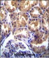 14 - TRPM6 (CHAK2) Antibody (Center) AP8053c