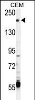 1 - TRPM6 (CHAK2) Antibody (Center) AP8053c