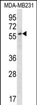 1 - ZNF506 Antibody (N-term) AP12770A