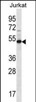 1 - FA8A1 Antibody (N-term) AP12791a