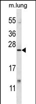 1 - XBP1 Antibody (C-term) AP12798b