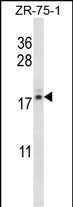1 - TNP2 Antibody (C-term) AP12809b