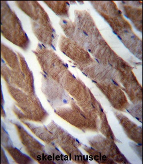 14 - MATN1 Antibody (C-term) AP12822b