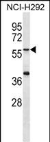 1 - MATN1 Antibody (C-term) AP12822b