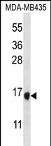 1 - TAC4 Antibody (C-term) AP12845B