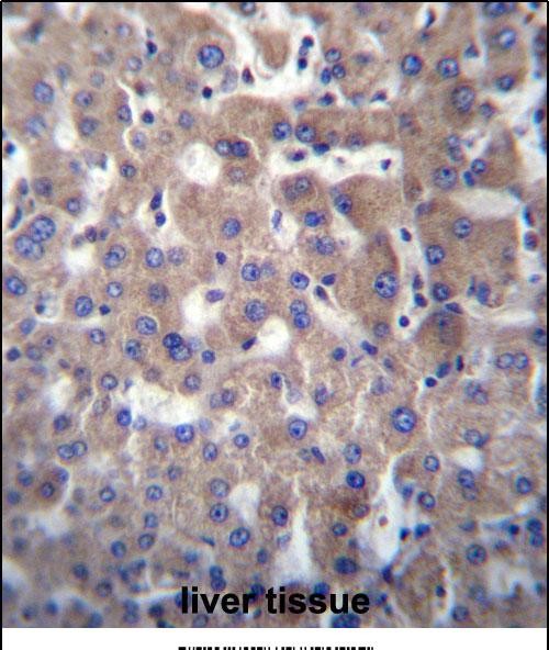 14 - GGT2 Antibody (N-term) AP12847a