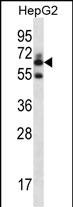 1 - GGT2 Antibody (N-term) AP12847a