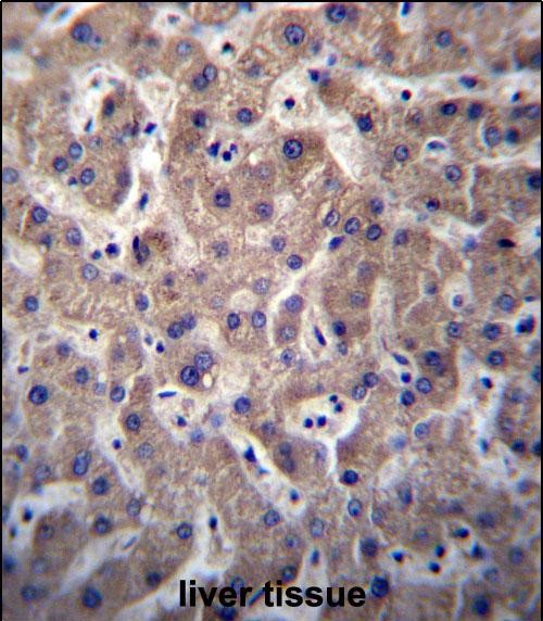 14 - SULT1A3/SULT1A4 Antibody (N-term) AP12849a