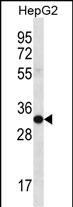 1 - SULT1A3/SULT1A4 Antibody (N-term) AP12849a