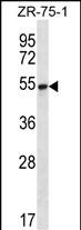 1 - SEC62 Antibody (N-term) AP12850a