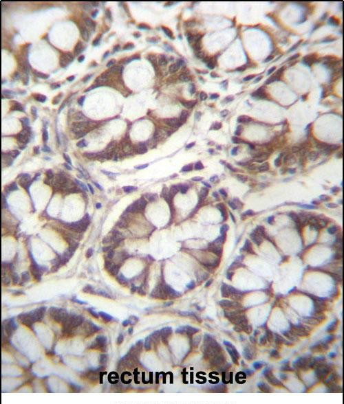 14 - LAD1 Antibody (N-term) AP12860a