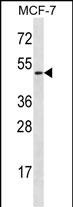 1 - LAD1 Antibody (N-term) AP12860a