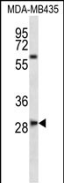1 - SLAMF8 Antibody (C-term) AP12868b