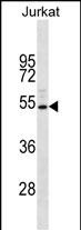 1 - SUV4-20H1 Antibody (N-term) AP12877a