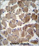 14 - COCH Antibody (Center) AP12909c