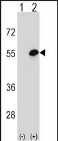 1 - COCH Antibody (Center) AP12909c