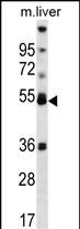 1 - PPARA Antibody (Center) AP12910c