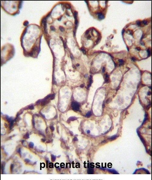 14 - MORN3 Antibody (Center) AP12954c