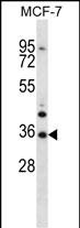 1 - MORN3 Antibody (Center) AP12954c
