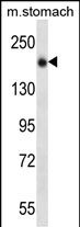 1 - UNC13B Antibody (N-term) AP13116A