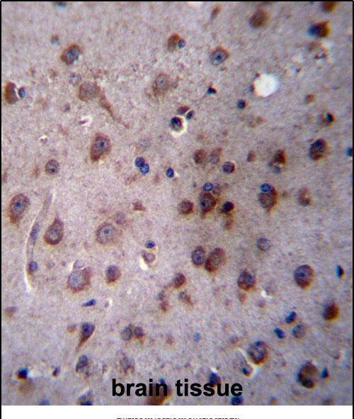 14 - TMED2 Antibody (N-term) AP13140A