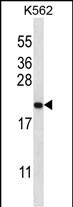 1 - GAGE2B Antibody (N-term) AP13173a