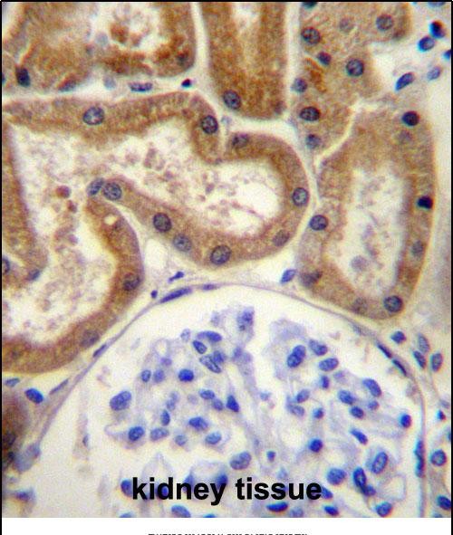 14 - FGD2 Antibody (C-term) AP13191b