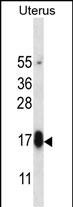 1 - GPHB5 Antibody (C-term) AP13233b