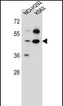 1 - SC65 Antibody (C-term) AP13238b