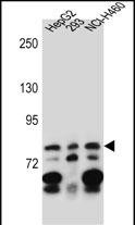 1 - ZNF555 Antibody (C-term) AP13239b