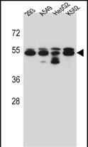 1 - TUBB8 Antibody (N-term) AP13248a