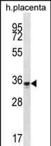 1 - OR6K6 Antibody (C-term) AP13262b