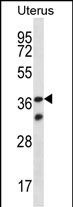 1 - OR4X2 Antibody (C-term) AP13266b
