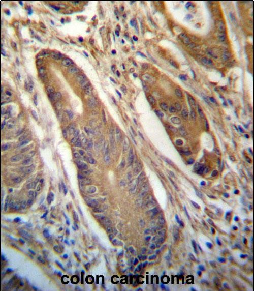 14 - NETO2 Antibody (N-term ) AP13322A