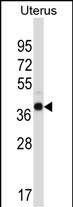 1 - WDR89 Antibody (C-term) AP13408b