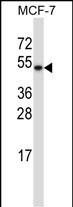 1 - TXNDC15 Antibody (C-term) AP13456B